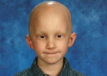 Jake Beresh, Ewing Sarcoma