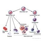 Non-Hodgkin Lymphoma